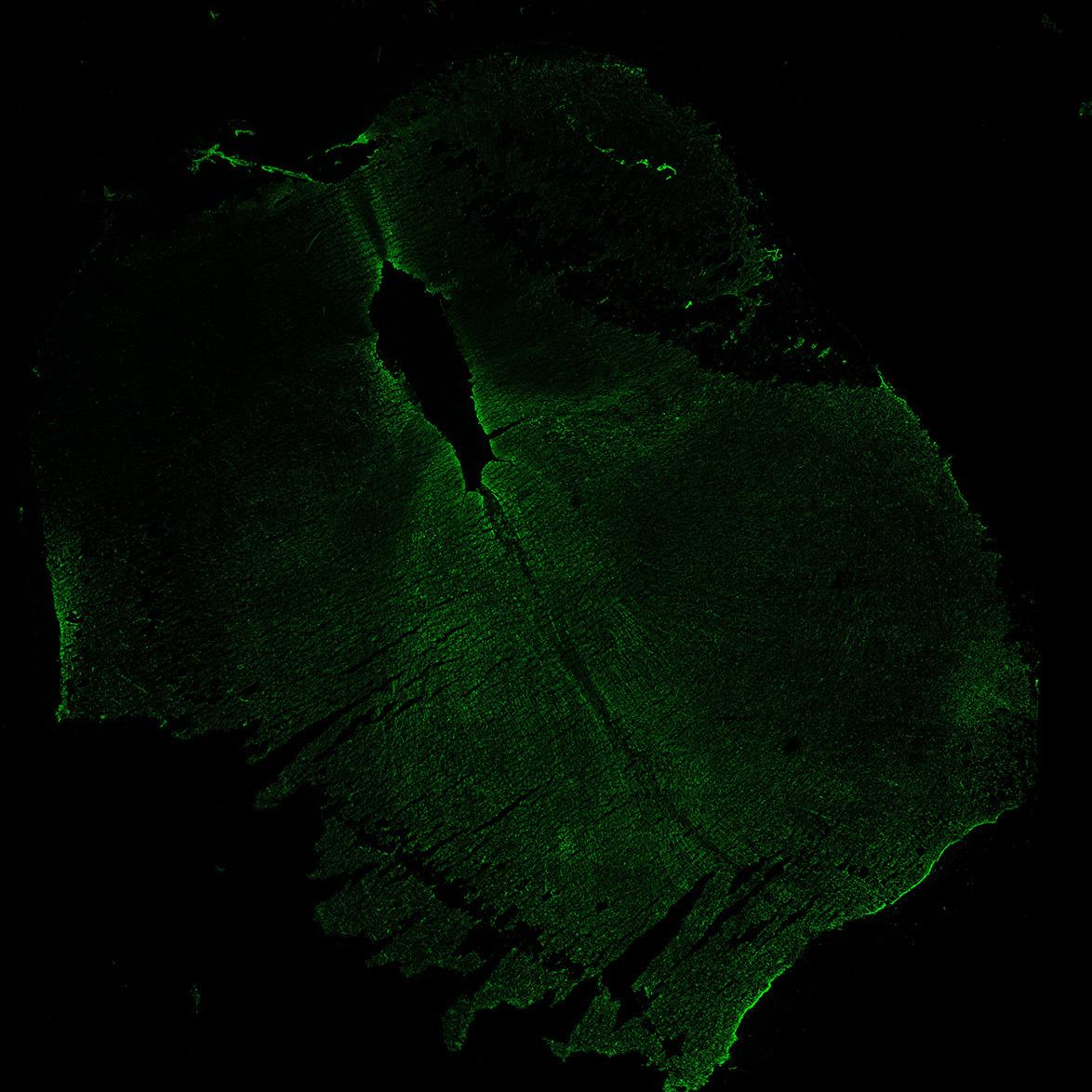 Human foetal midbrain